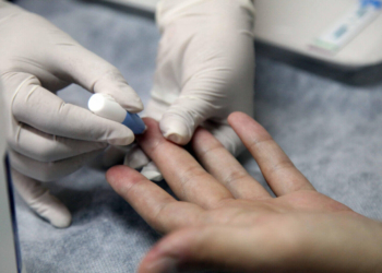 Sida: en el Centro Especializado local se reciben 1.500 consultas por mes para diagnósticos