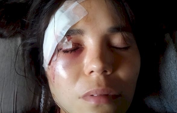 La víctima hospitalizada