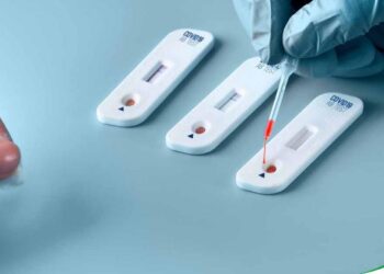 Salud presentó la actualización del AutoTest Coronavirus